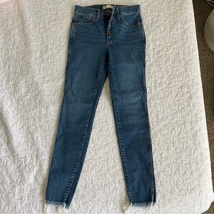 Madewell 10" High-Rise Skinny Jeans
